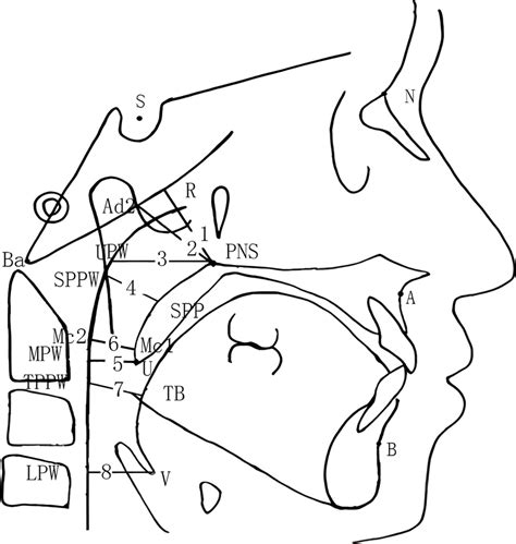 Measurement Items Of The Upper Airway 1 The Distance Between The
