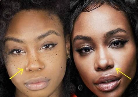 Sza Before And After Plastic Surgery Everything You Need To Know