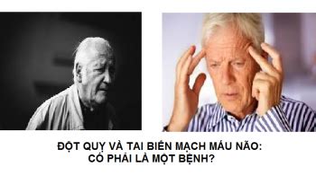 Đột quỵ não là một chứng bệnh mà ai cũng sợ, là bệnh nguy hiểm đối với sức khỏe. Đột quỵ và Tai biến mạch máu não