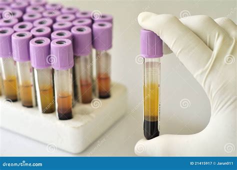 Blood Sample Stock Image Image Of Medicine Health Sample 21415917