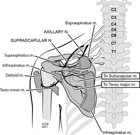 Analgesic Efficacy And Technique Of Ultrasound Guided Suprascapular