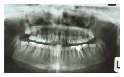 First Visit A Extraoral Frontal Photography B Intraoral