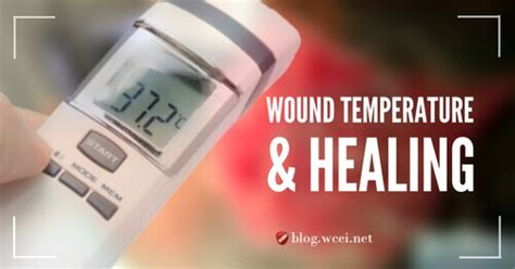 Significant or prolonged bleeding and the lack of scab formation indicate the need for advanced medical care. Wound Temperature and Healing - WCEI - Blog WCEI - Blog