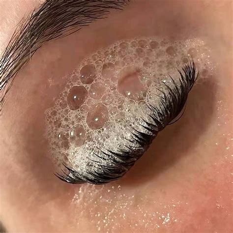 Can You Get Blepharitis From Eyelash Extensions