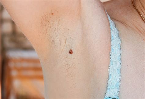 Why Do We Grow Hair In The Armpits Healthy Ask
