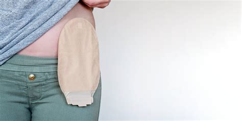 7 Types Of Ostomy Bags To Use After Surgery