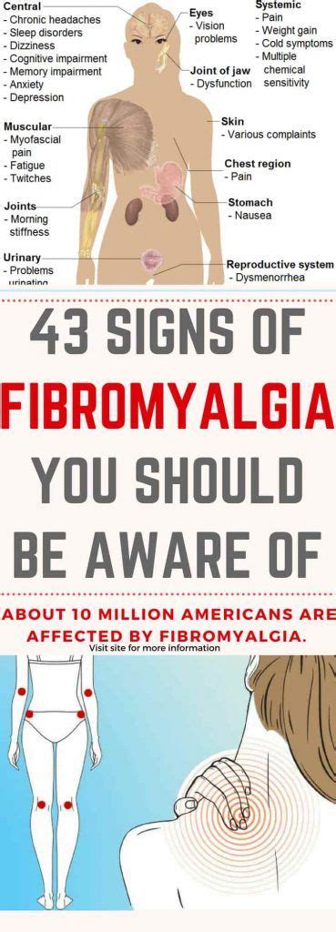 43 Signs Of Fibromyalgia You Should Be Aware Of Signs Of Fibromyalgia