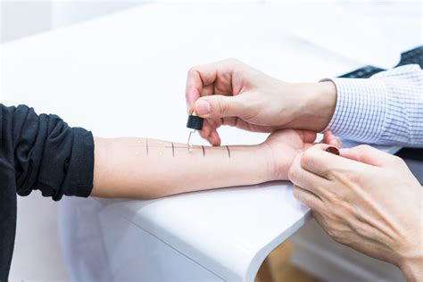 Allergy Testing In Singapore Skin Prick And Blood Test Kidsadults