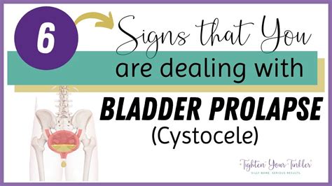 6 Signs That You Are Dealing With Bladder Prolapse Cystocele