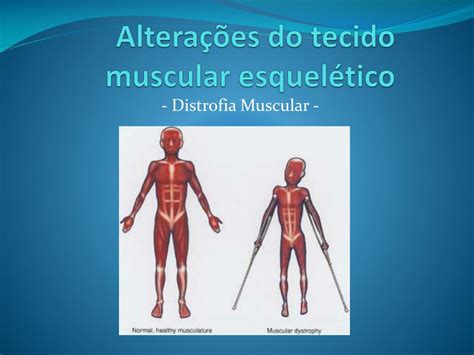 Doenças Do Sistema Esquelético