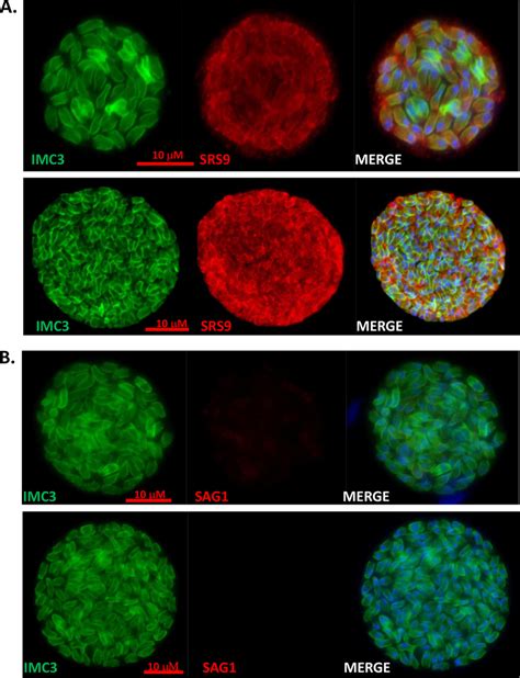 Replicating Parasites Within Tissue Cysts Are Bradyzoites A Tissue