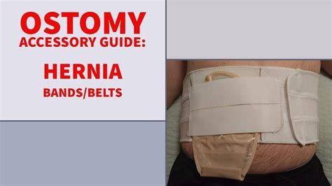 Ostomy Accessories Guide Hernia Belts Veganostomy
