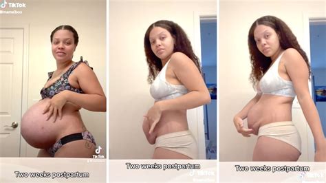 New Mom Shares What Her Stomach Looks Like 2 Weeks Postpartum