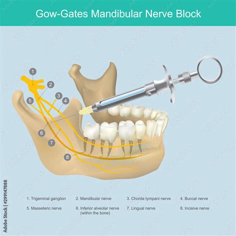 Mandibular Nerve Block Illustration Reference To Dentist The Lower Jaw