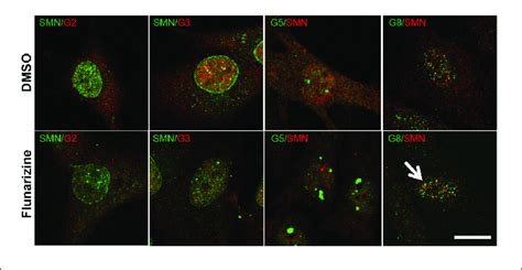 Sub Cellular Localization Of Smn With Gemins 2 3 5 And 8 Following