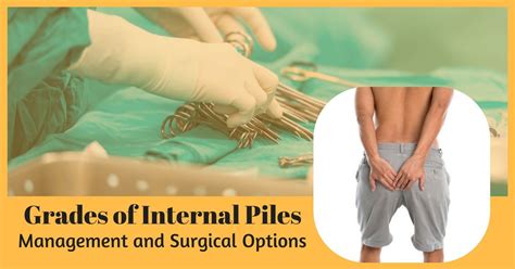 More About Grades Of Internal Piles Its Management And Surgical