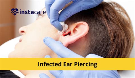 How To Get Rid Of An Infected Ear Piercing