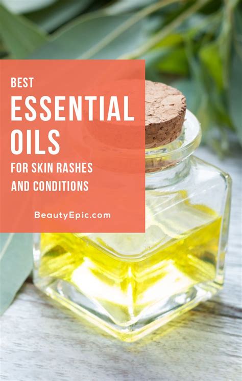 16 Best Essential Oils For Skin Rashes And Conditions Essential Oils