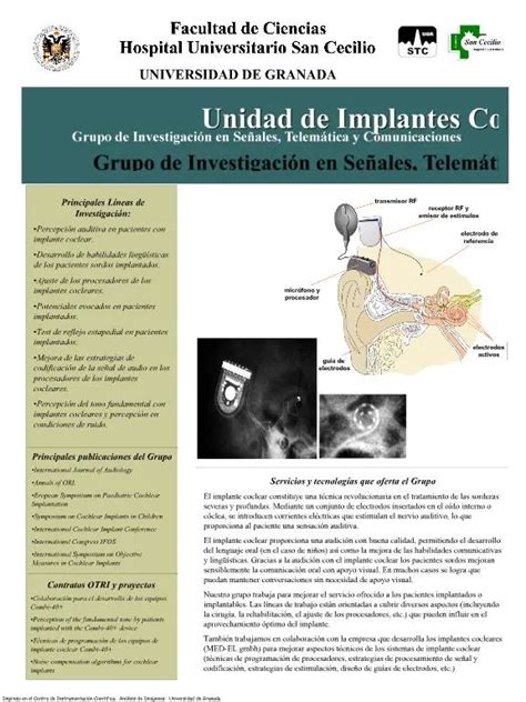 Ppt Unidad De Implantes Cocleares Grupo De Investigaci N En Se Ales