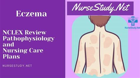 Eczema Nursing Diagnosis And Nursing Care Plan Nursestudynet