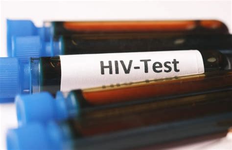 Researchers Announce Plan To End Hiv In Black America Afro American
