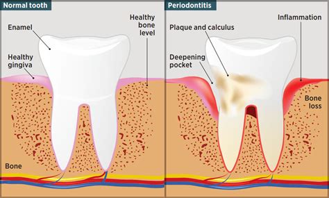 The Effects Of Oral Health On Systemic Health Dental Wellness Center