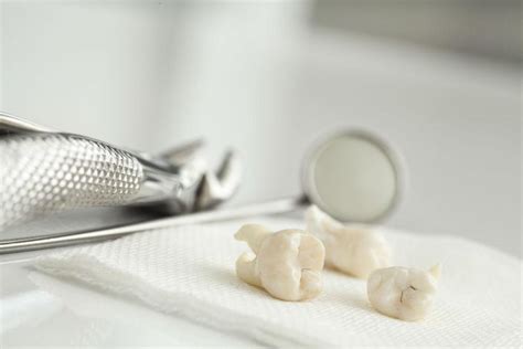 Things You Need To Know About Pericoronitis And Wisdom Teeth Dentists