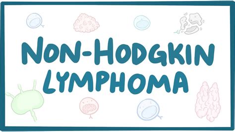 Hodgkin lymphoma spreads the disease from one group of lymph to another group. Non-hodgkin lymphoma - causes, symptoms, diagnosis ...