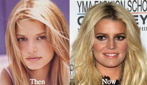 jessica simpson before and after nose job