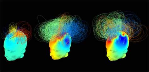 Brain Body And Mind Understanding Consciousness University Of Cambridge