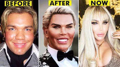 People Who Had Extreme Plastic Surgery Youtube