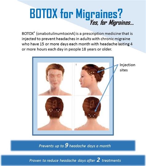 Botox For Migraine Airport Plaza Spine And Wellness