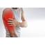Upper Arm Muscle Pain Symptoms&ampCauses  First Aid Reference