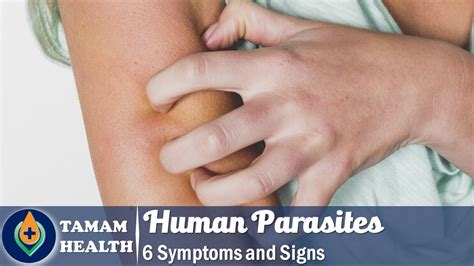 6 Symptoms Of Human Parasites Everyone Should Know Youtube