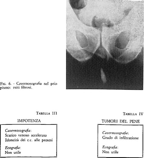 Confronto Fra L Utilit Dell Ecografia E Della Cavernosografia Nella Patologia Dei Corpi