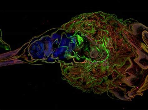 Here's a video you might like too. 2015 Photomicrography Competition | Nikon's Small World