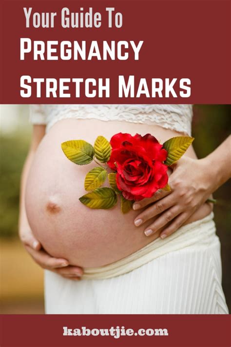 your guide to pregnancy stretch marks