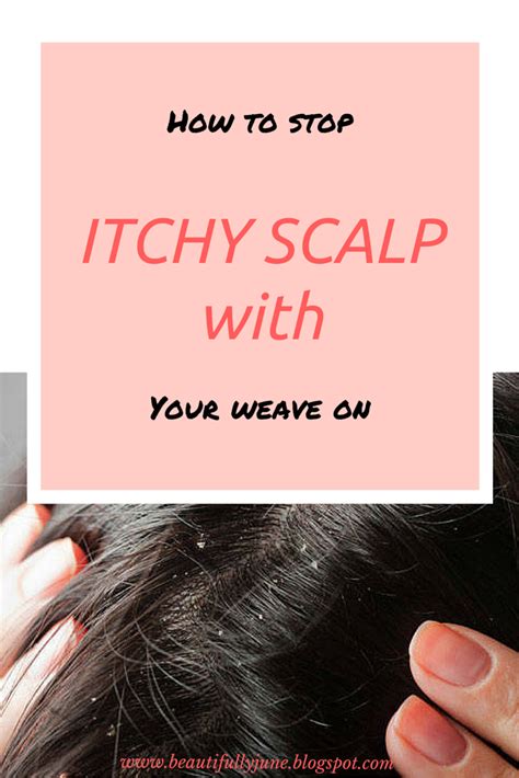 How To Stop Itchy Scalp With Your Weave On Beauty Fables