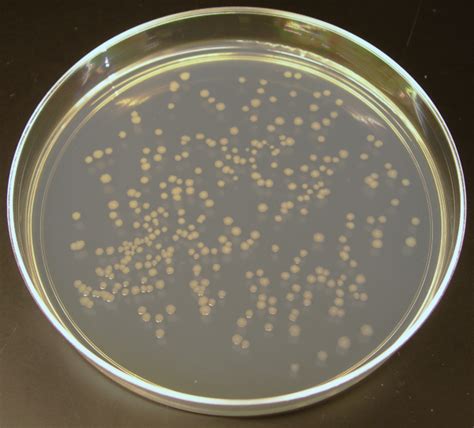 Li On Nutrient Agar Plates Microbiology Growth Medium