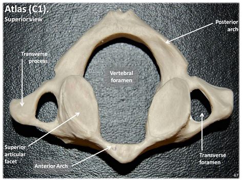 The atlas is one of the two upper cervical vertebrae, also known as c1, which is the topmost vertebra of the spinal column. Atlas C1 vertebra, superior view with labels - Axial Skele ...