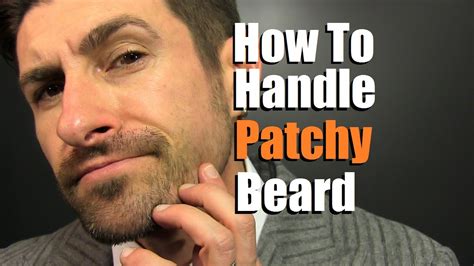 How To Deal With A Patchy Beard Bald Spot Reduction Tips Youtube