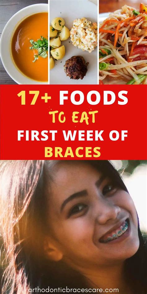 what to eat with braces the first week [with list] orthodontic braces care