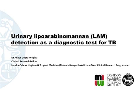 Urinary Lipoarabinomannan Lam Detection As A Diagnostic Test For Tb