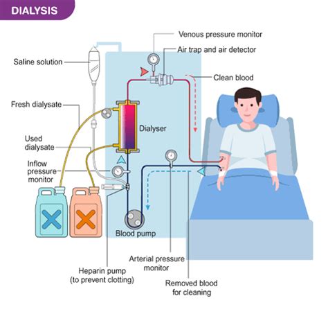 Dialysis Clinical Knowledge And Medicine