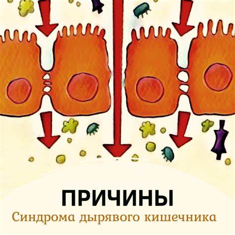 Синдром раздраженной кишки лечение диета Синдром Дырявой Кишки Симптомы Лечение И Диета — Похудение Диета Синдром Дырявой Кишки Симптомы Лечение И Диета — Похудение Диета Синдром раздраженной кишки лечение диета