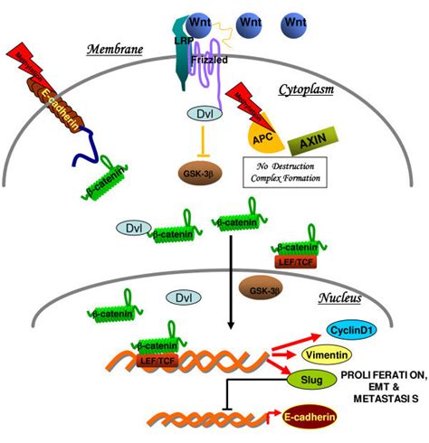 Schematic diagram showing Wnt β catenin signaling in Invasive ductal