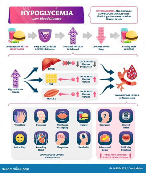 Hypoglycemia Vector Illustration Labeled Low Sugar Level Medical