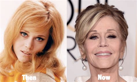 Jane Fonda Plastic Surgery Before and After Photos