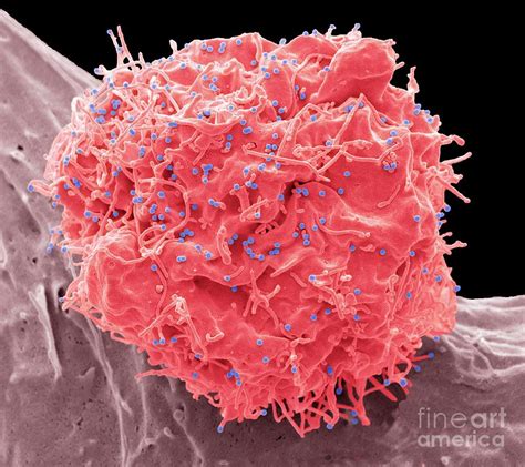 Hiv Infected Cell Photograph By Steve Gschmeissnerscience Photo