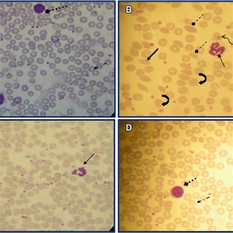 Erythrocytes Morphology Of Controls A Mm Treated B Download